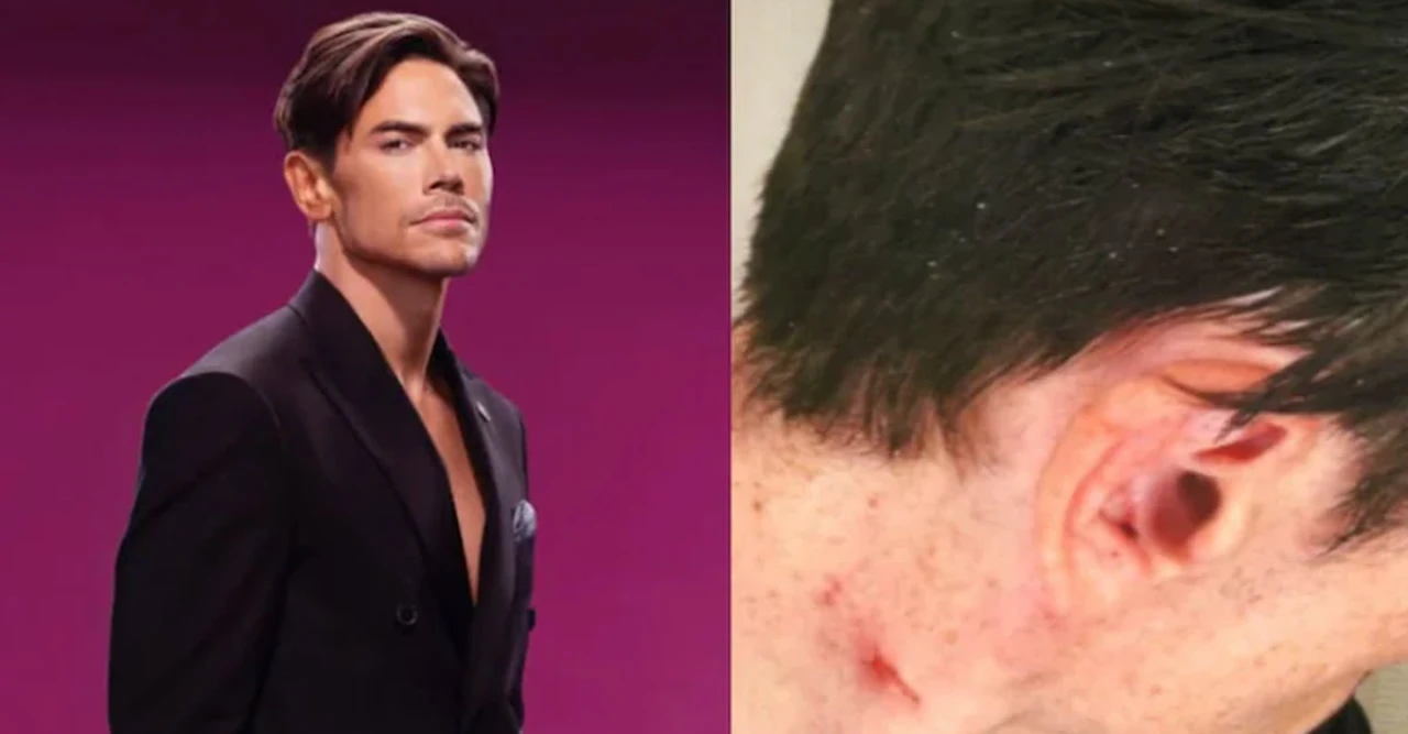 Tom Sandoval Files Restraining Order Against Ex-Girlfriend, Alleges Pattern of Physical and Verbal Abuse