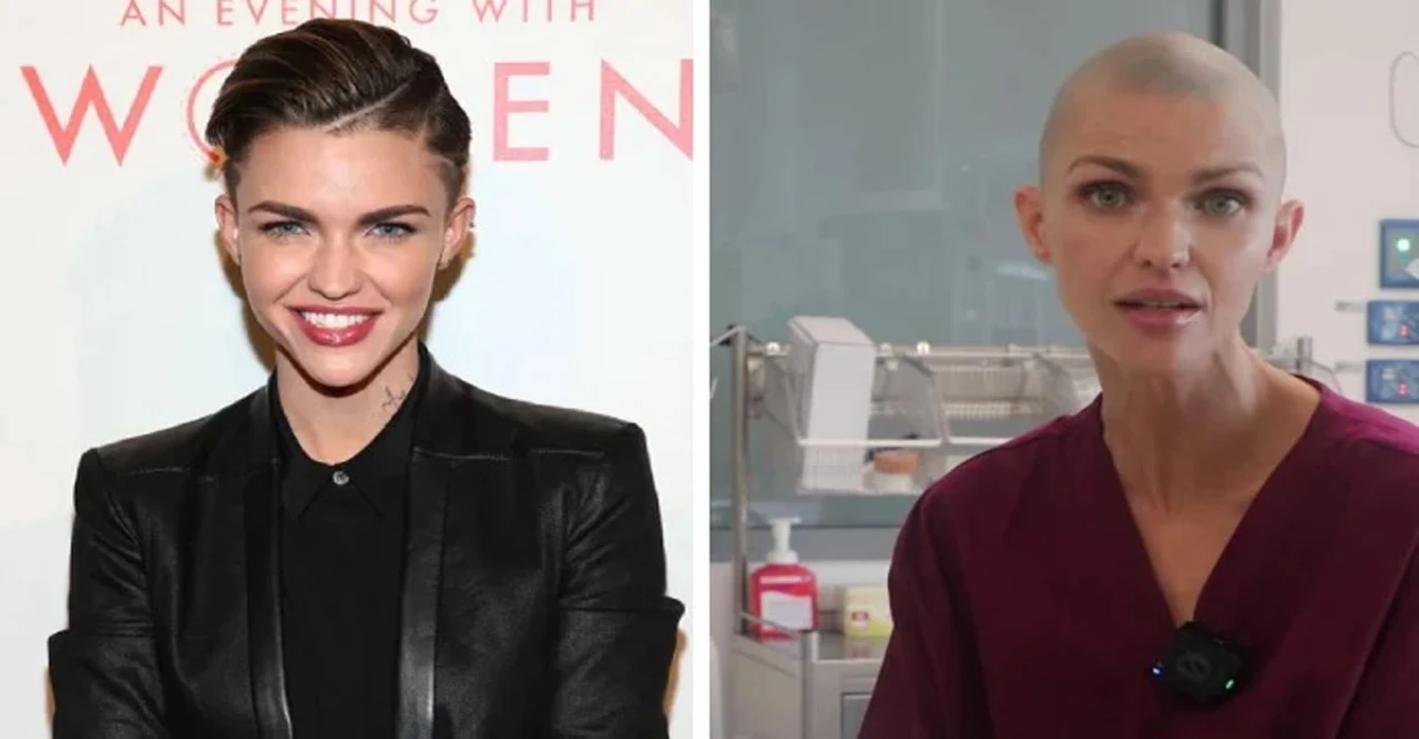 Ruby Rose Hospitalized After Breaking Ribs in Freak Pool Accident at Her Home