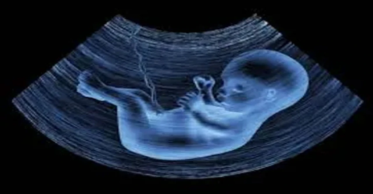 Pakistan Busts Major International Placenta Smuggling Ring in Capital Raid
