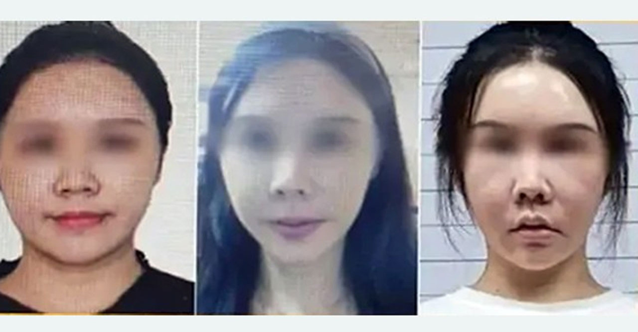 গ্রেপ্তার এড়াতে প্লাস্টিক সার্জারি করেও শেষ রক্ষা হলো না