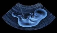 Pakistan Busts Major International Placenta Smuggling Ring in Capital Raid